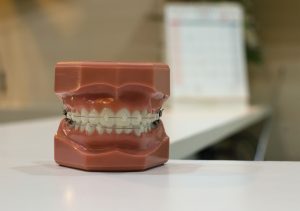 Model of human teeth on table